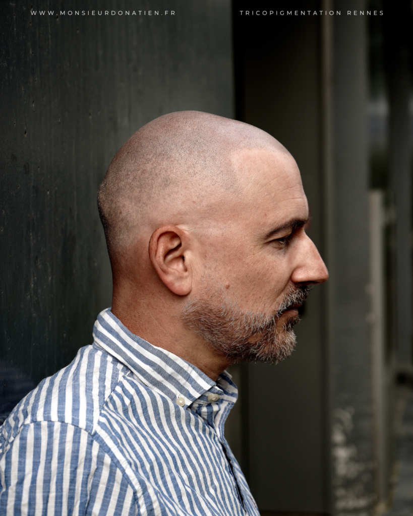 Micropigmentation effet rasé 