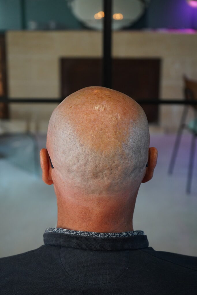 Photo de dos : avant 