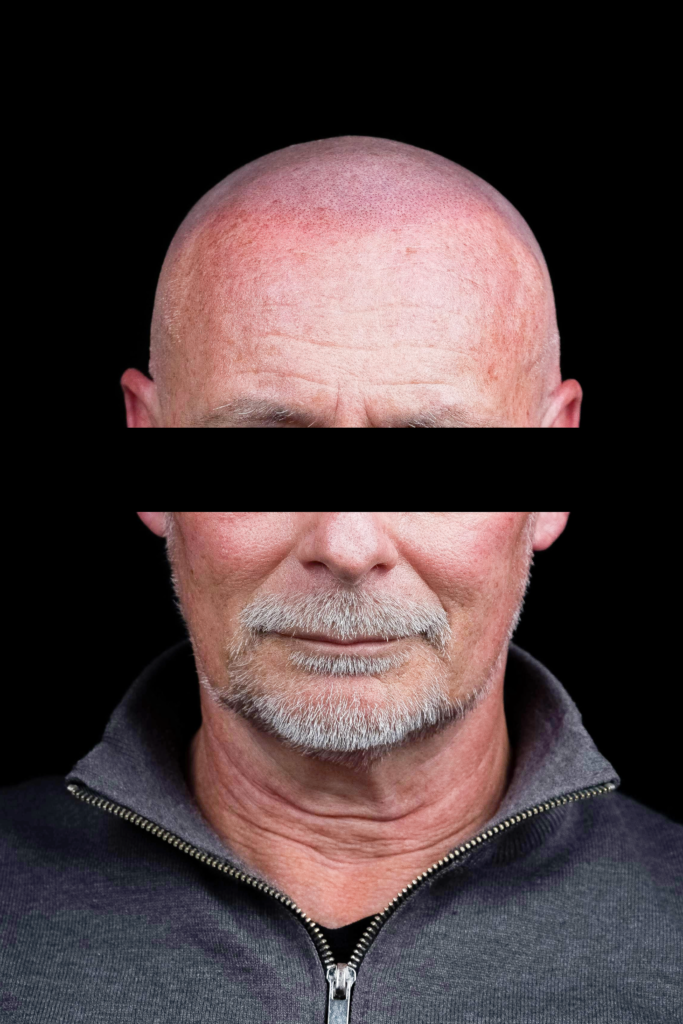 Photo de face : après – redessin de la ligne frontale et effet rasé équilibré